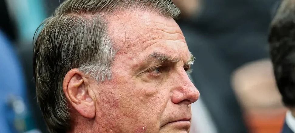 Bolsonaro deixa prisão domiciliar para cirurgia em Brasília
