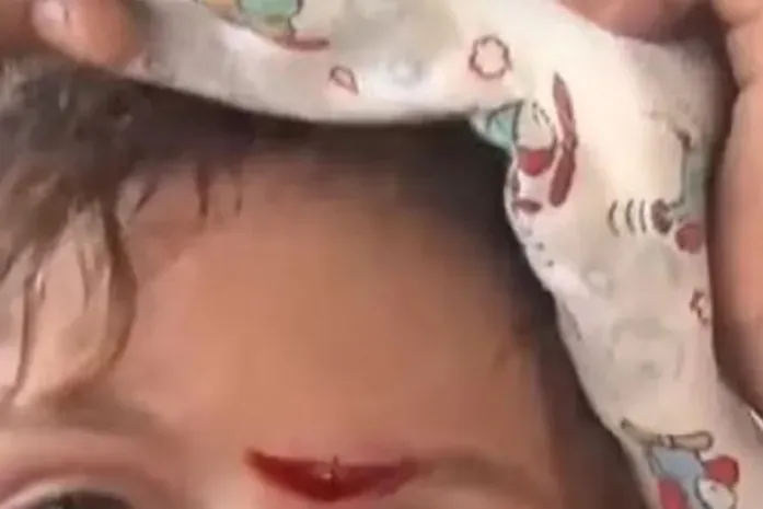 Menina é ferida na testa após mãe arremessar celular; mulher é presa em flagrante