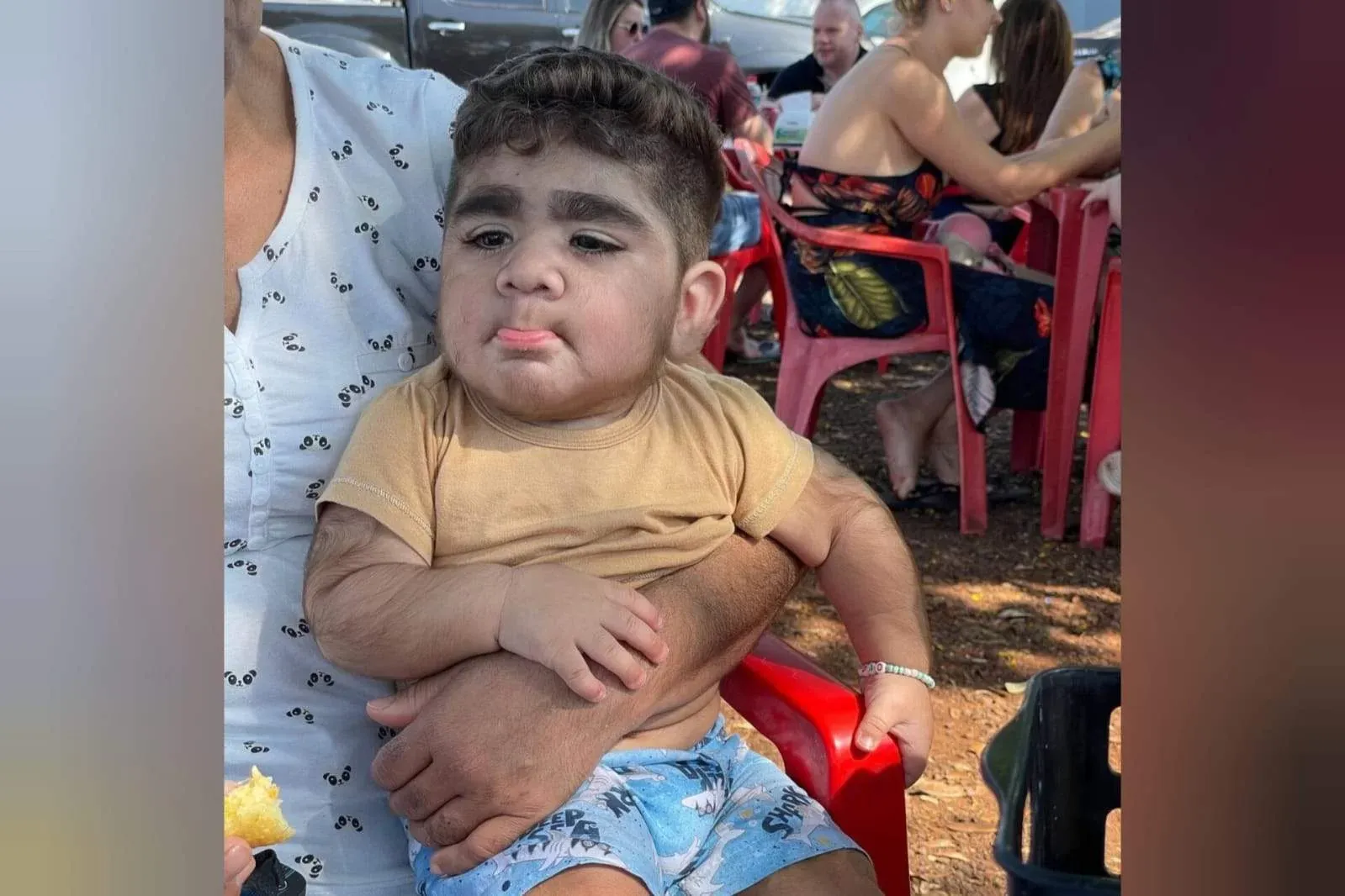 Bebê brasileiro que nasceu com barba viraliza no TikTok