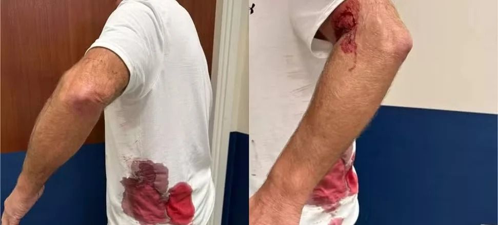 Idoso é chifrado por veado durante caminhada no parque