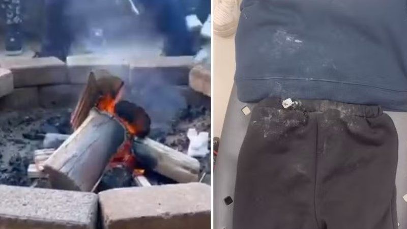 Criança de 3 anos sofre queimaduras após cair em fogueira de escola