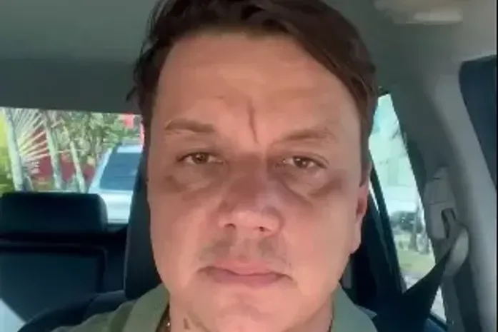 Tomógrafo quebrado há 5 meses expõe crise na rede hospitalar de Alagoas, denuncia vereador