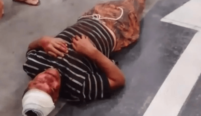 Segurança de supermercado de Maceió é suspeito de espancar cliente com soco inglês e fugir após o crime